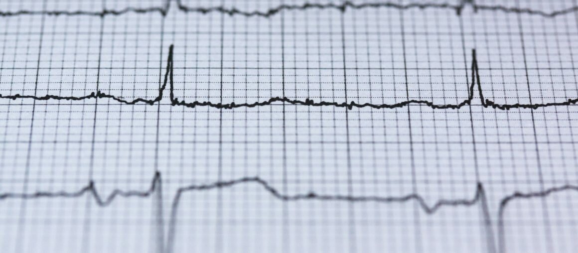 Les 10 règles d’Or pour surveiller son cœur pendant l’effort